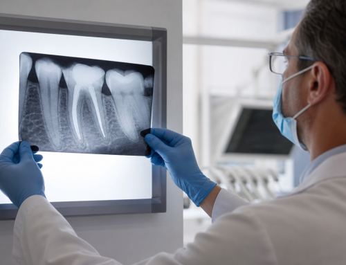 Root Canal in Tulsa: What to Expect, Cost, and Recovery