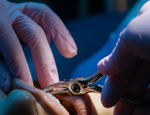 Tooth Extraction in Tulsa: What to Expect and How We Can Help