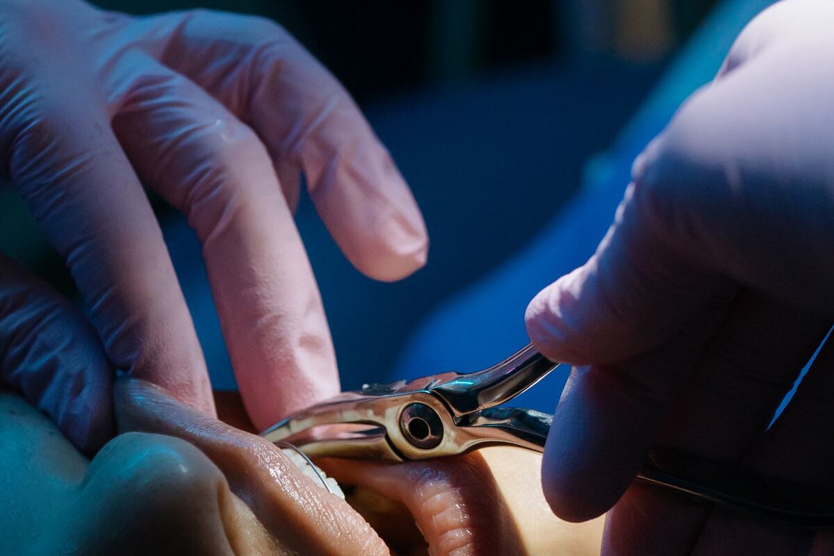 Dentist performing a gentle tooth extraction procedure at South Tulsa Dental in Tulsa Oklahoma