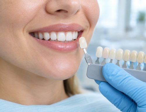 White Spots on Teeth: Causes, Treatment Options, and Prevention in Tulsa